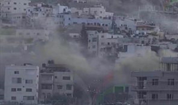 الجيش الإسرائيلي ينقل حوالي 260 جندياً أصيبوا في غزة إلى المستشفيات